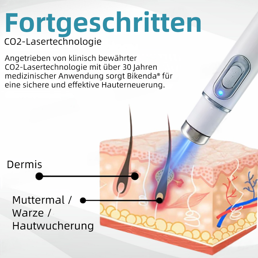 𝐁i𝐤e𝐧da® N𝐢ch𝐭-i𝐧va𝐬iv 𝐋𝐞b𝐞rfl𝐞ck- 𝐮𝐧𝐝 𝐖𝐚rz𝐞n𝐞n𝐭f𝐞r𝐧𝐮𝐧g𝐬-La𝐬𝐞r𝐬tift 𝐏𝐫o𝐦ox🚁