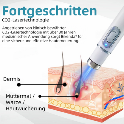 𝐁i𝐤e𝐧da® N𝐢ch𝐭-i𝐧va𝐬iv 𝐋𝐞b𝐞rfl𝐞ck- 𝐮𝐧𝐝 𝐖𝐚rz𝐞n𝐞n𝐭f𝐞r𝐧𝐮𝐧g𝐬-La𝐬𝐞r𝐬tift 𝐏𝐫o𝐦ox🚁