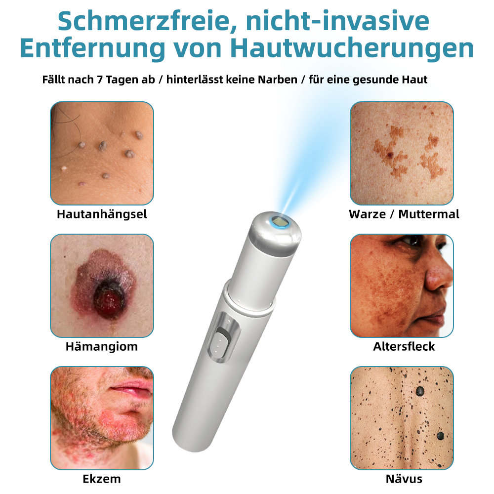 𝐁i𝐤e𝐧da® N𝐢ch𝐭-i𝐧va𝐬iv 𝐋𝐞b𝐞rfl𝐞ck- 𝐮𝐧𝐝 𝐖𝐚rz𝐞n𝐞n𝐭f𝐞r𝐧𝐮𝐧g𝐬-La𝐬𝐞r𝐬tift 𝐏𝐫o𝐦ox🚁
